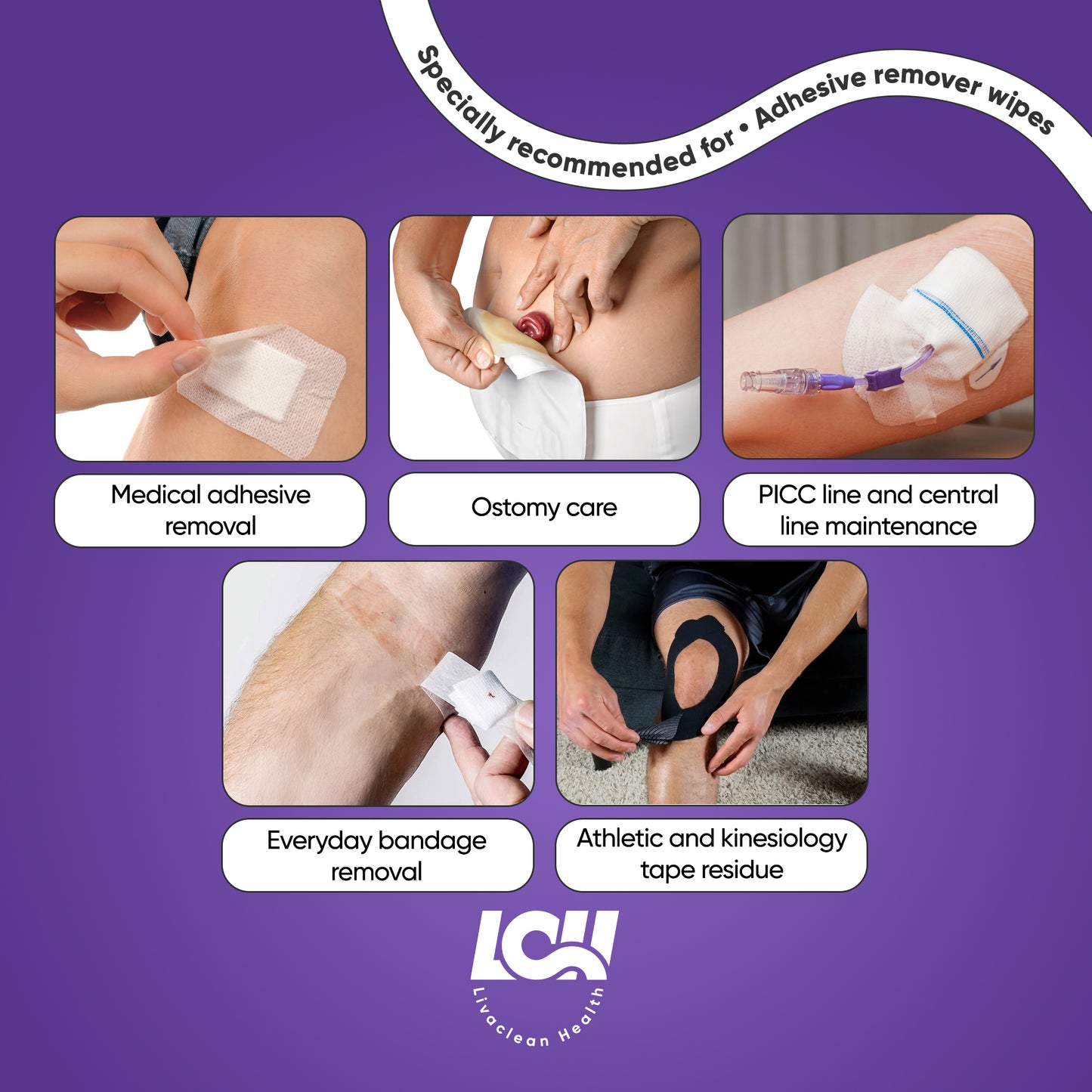 100 CT Adhesive Remover Wipes - Strong & Effective 2.56x1.18in (6.5x3cm)