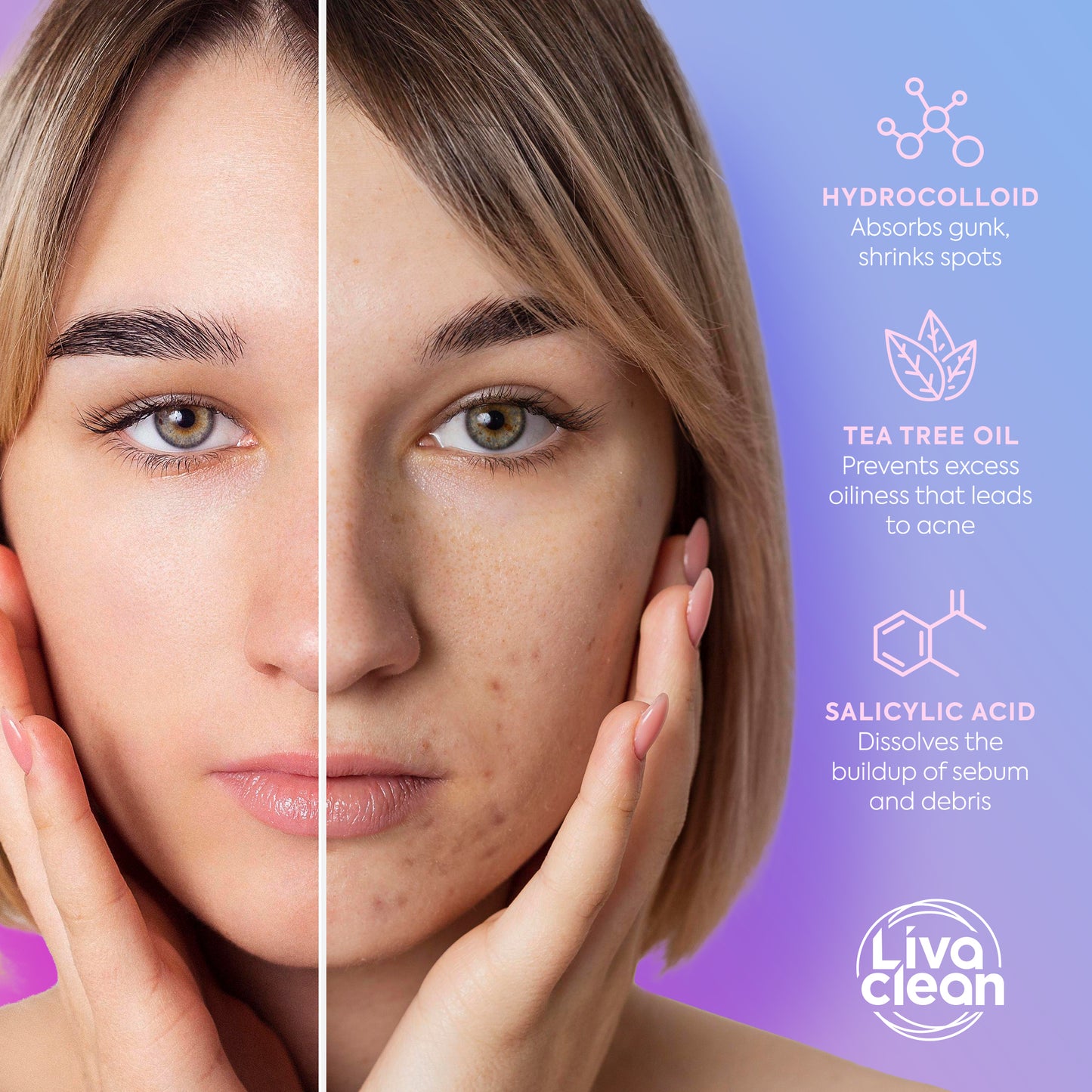 240ct Bright Blossoms Pimple Patches
