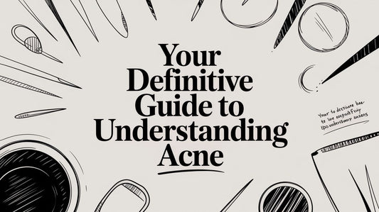 Your Definitive Guide to Understanding Acne