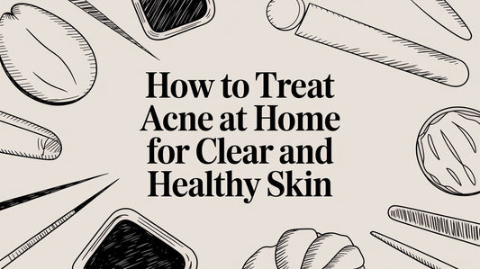 How to Treat Acne at Home for Clear and Healthy Skin