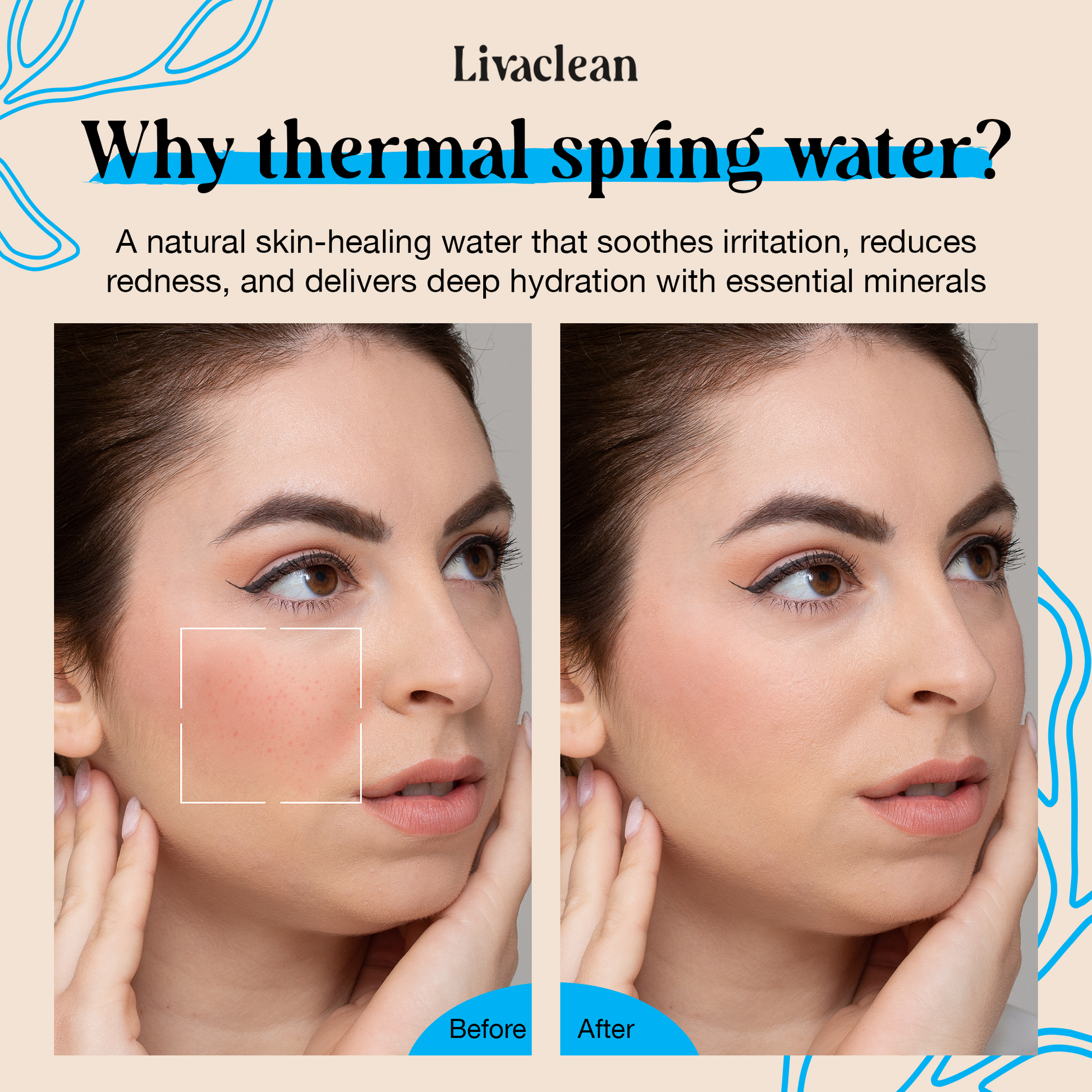 10 fl oz + 1.7 fl oz Thermal Spring Water Hydrating & Soothing Face Mist w/ Hyaluronic Acid & Aloe Vera - Image 5