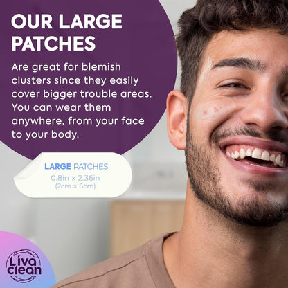 60CT Large Hydrocolloid Pimple Patches - Salicylic Acid, Tea Tree Oil & Calendula Oil