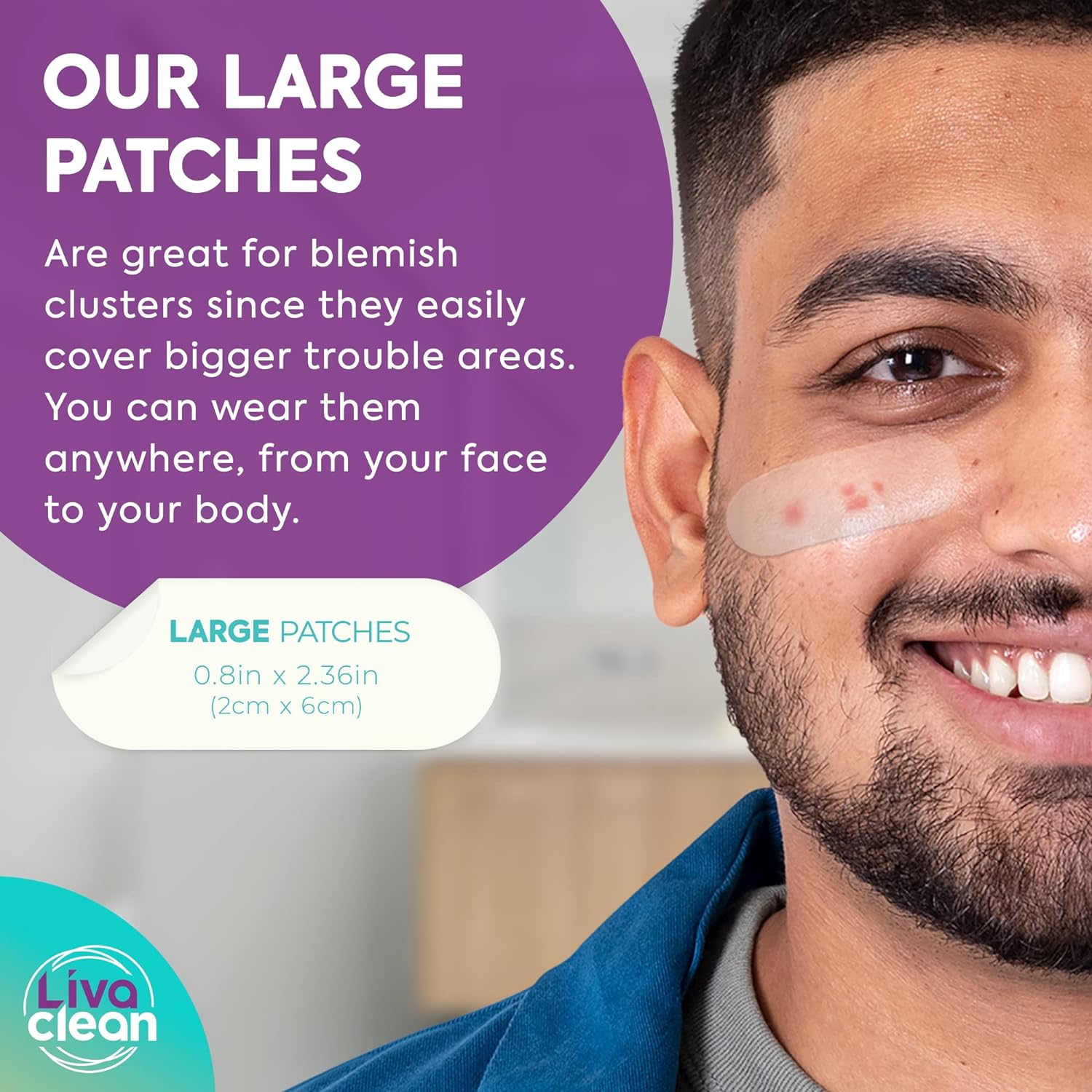 hydrocolloid dressing cystic acne Do Patches for Actually Work? free with LivaClean pimple patch. 20 ct Large Hydrocolloid Pimple