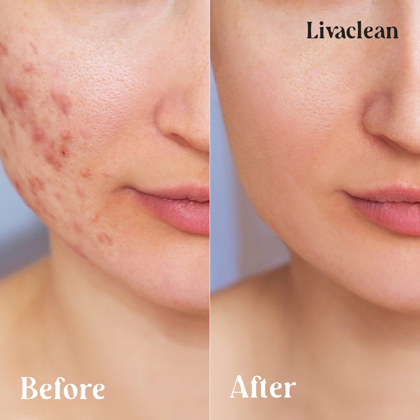 60 CT 20% Glycolic Acid Peel Pads